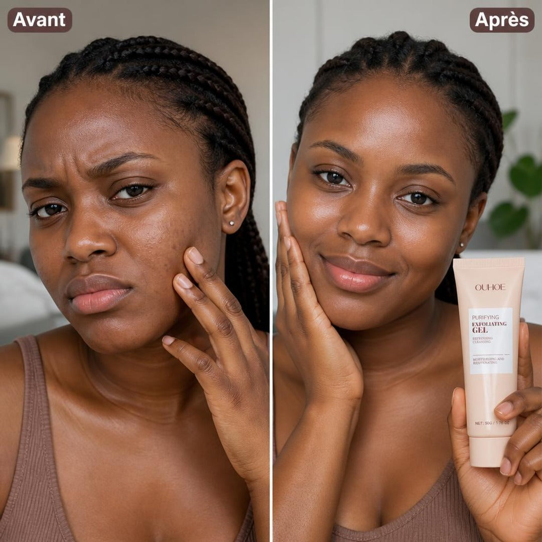 Avant / Après 2 — Résultats visibles