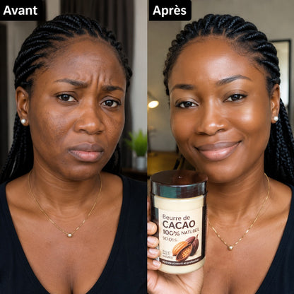 Avant / Après 2 — Résultats visibles