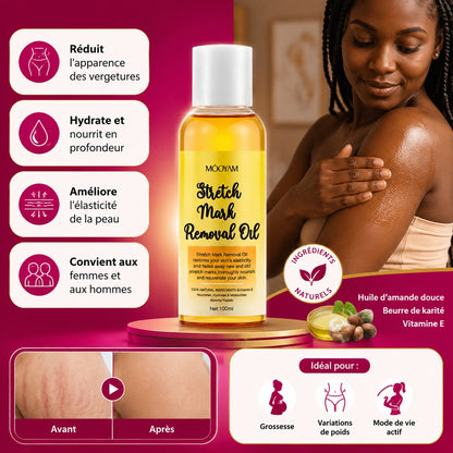 Affiche — Huile Anti-Vergetures Naturelle - Réduit les Vergetures et Nourrit la Peau
