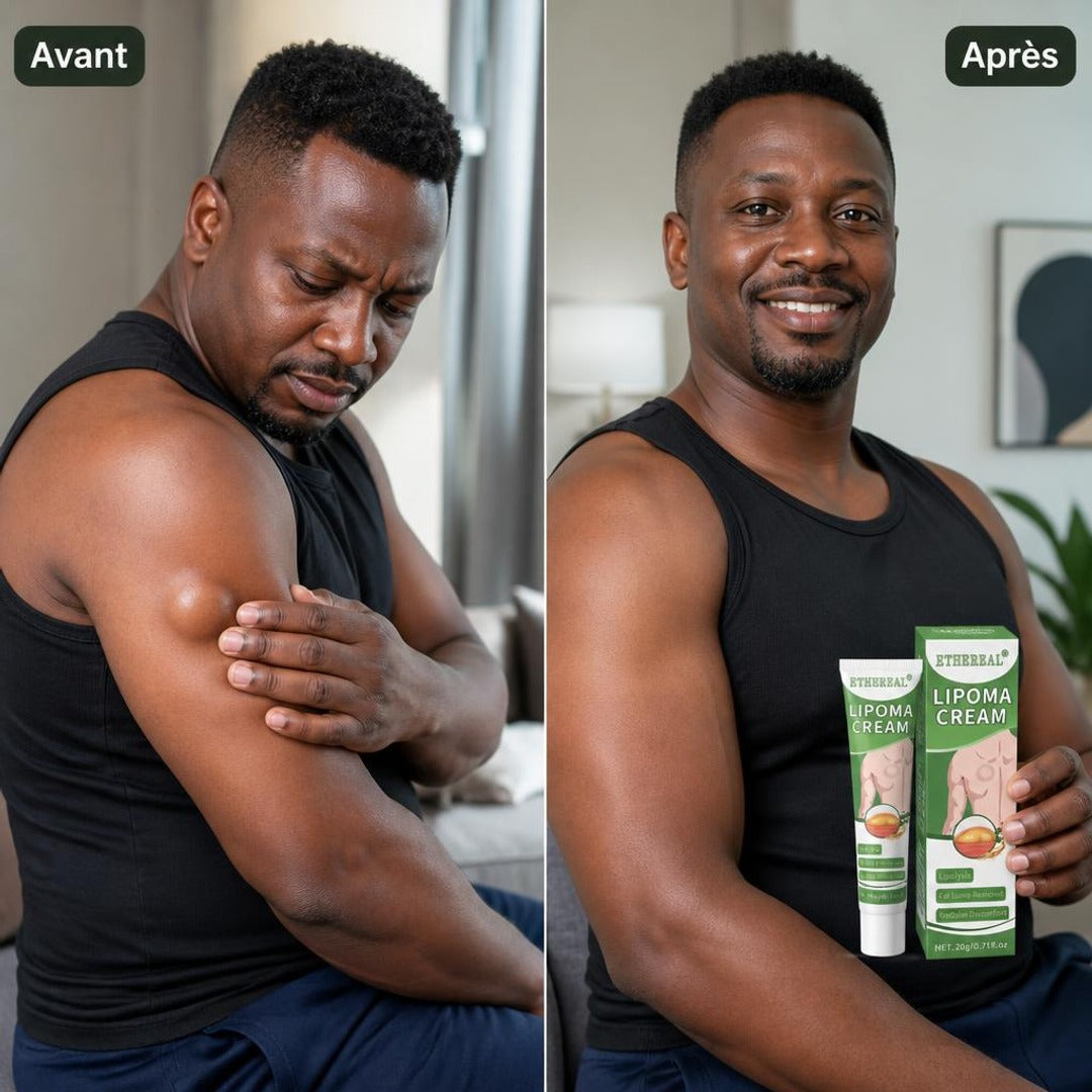 Avant / Après 2 — Résultats visibles
