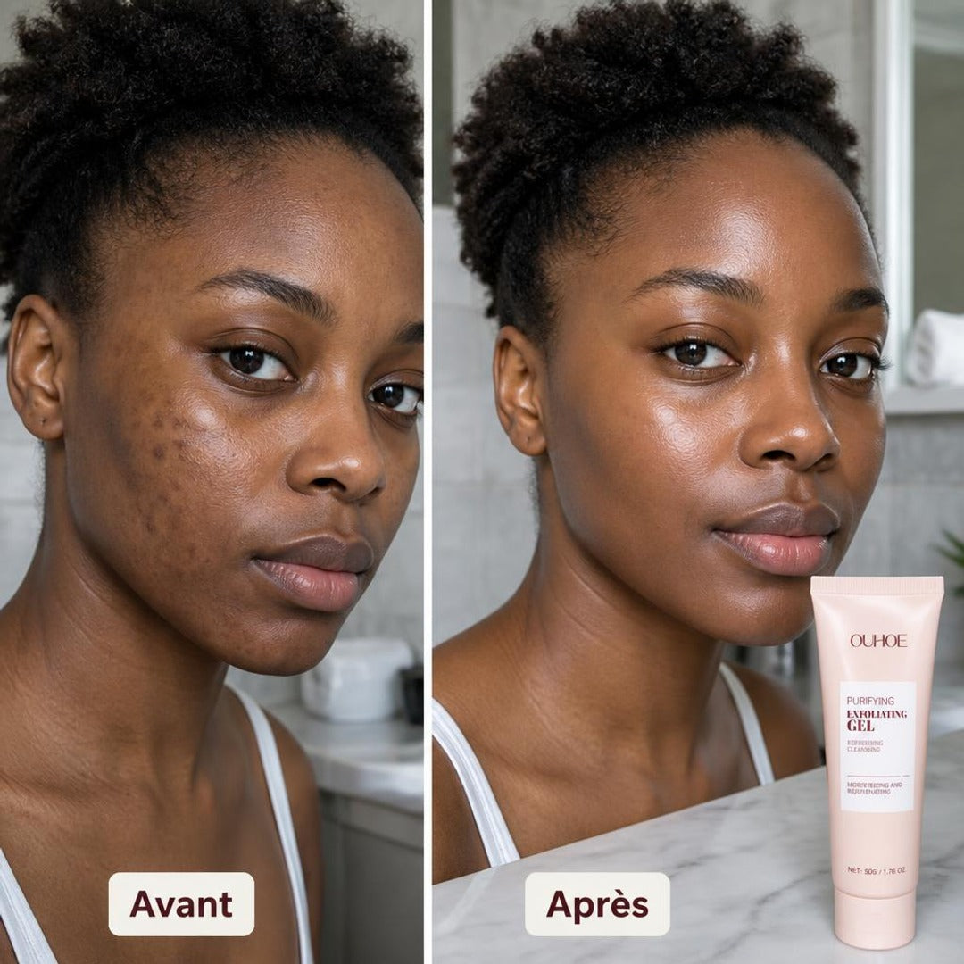 Avant / Après 1 — Résultats visibles